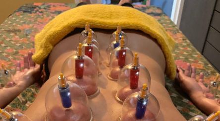Thai Massage Teneriffa, Sak Thong Los Cristianos - Schröpftherapie-Massage